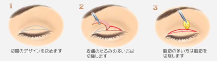 eye-002