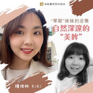 割雙眼皮kiki